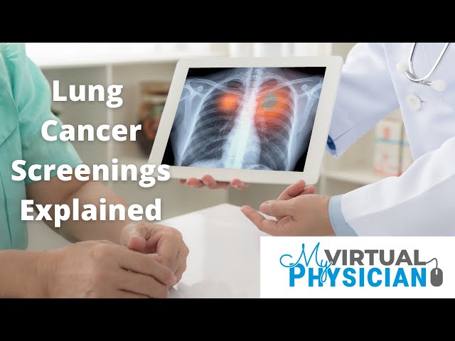 Lung Cancer Screenings Explained