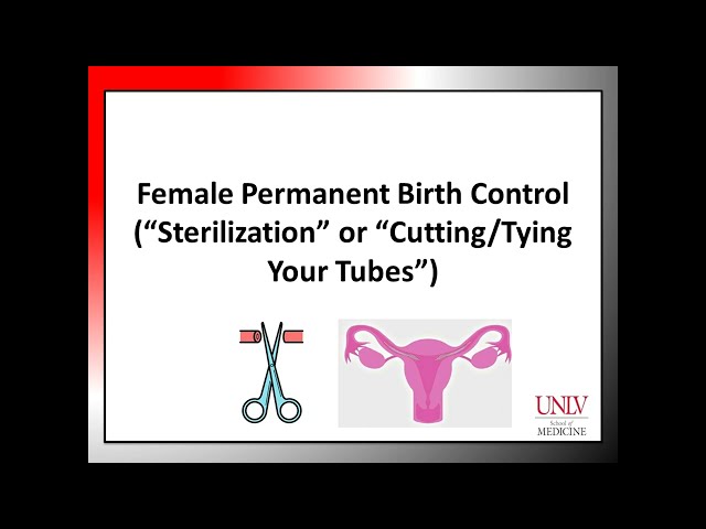 BC Module 1.4 Female Permanent Birth Control